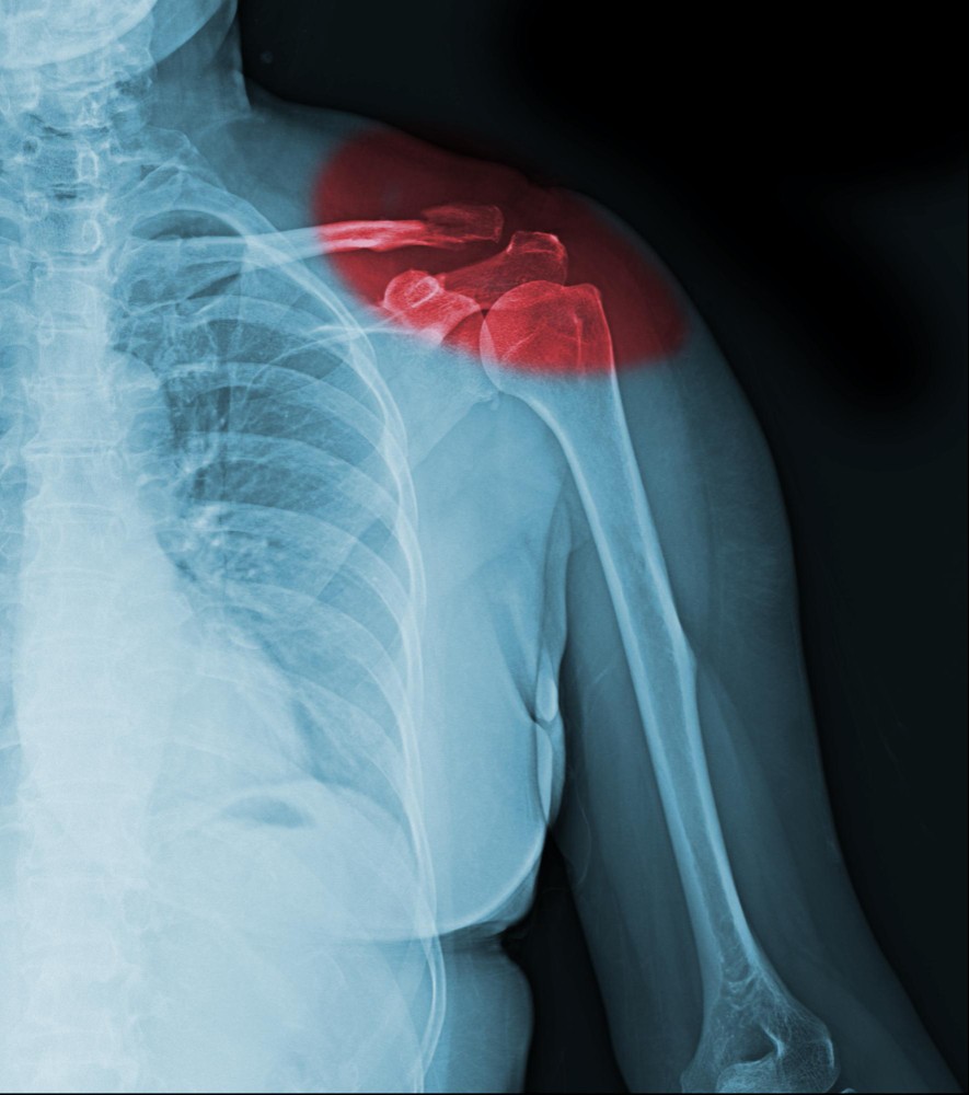 physiotherapy Hamilton