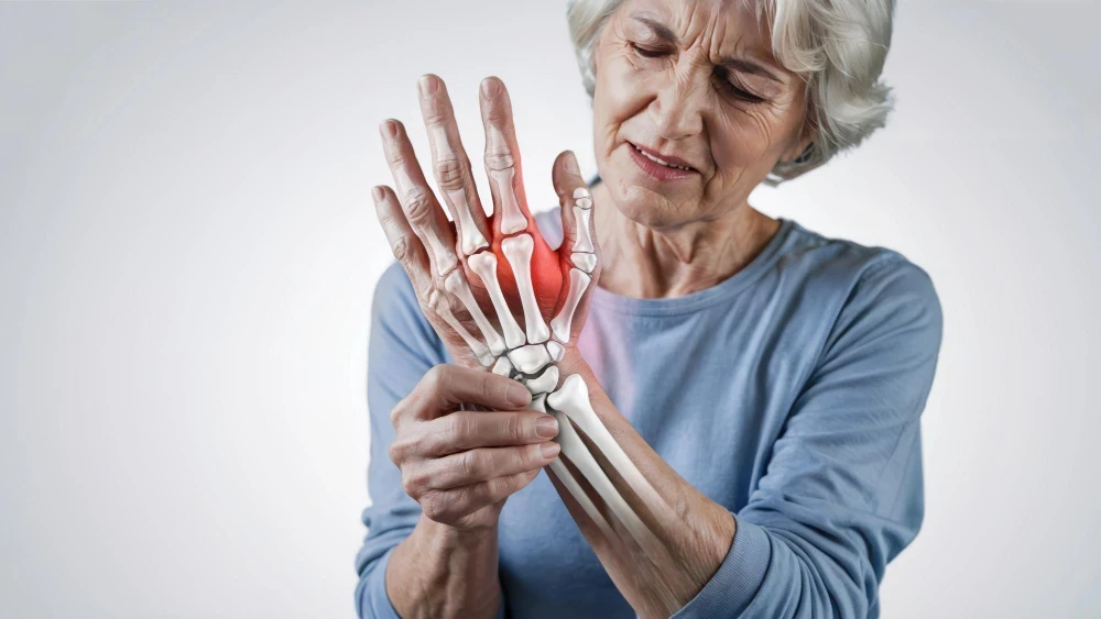 Arthritis