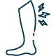 Shin Splints